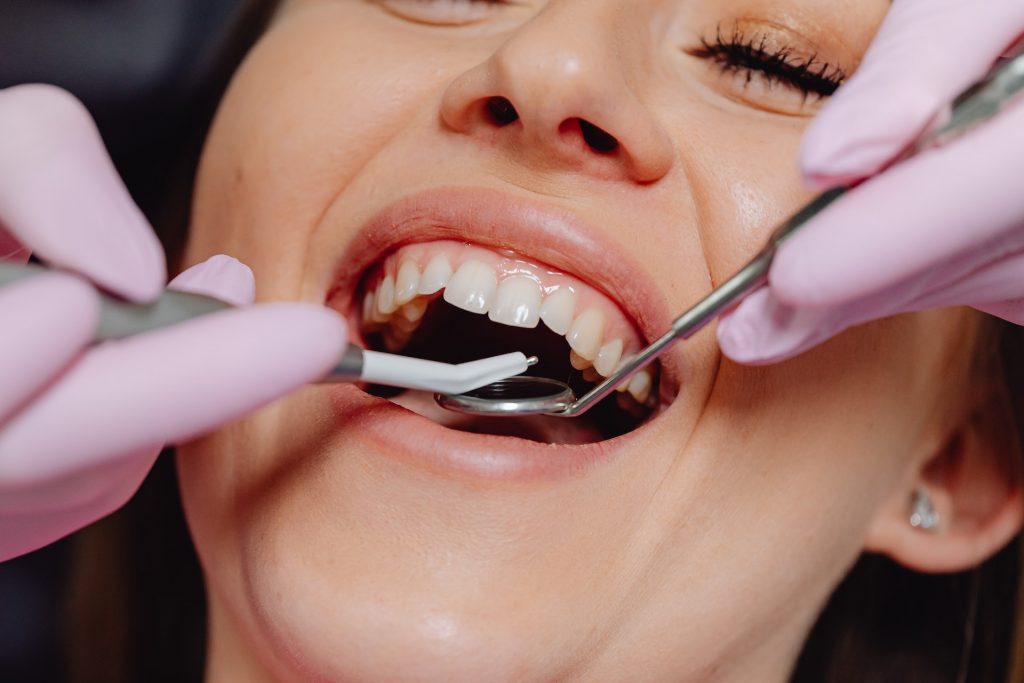periodontics treatment in San Jose
